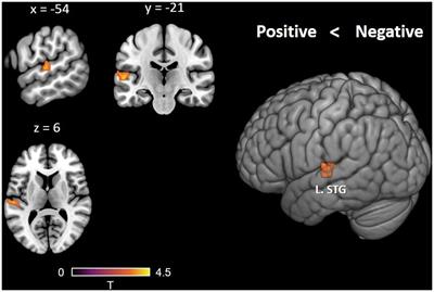 Neural pathways of attitudes toward foreign languages predict academic performance